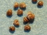 Foraminifera